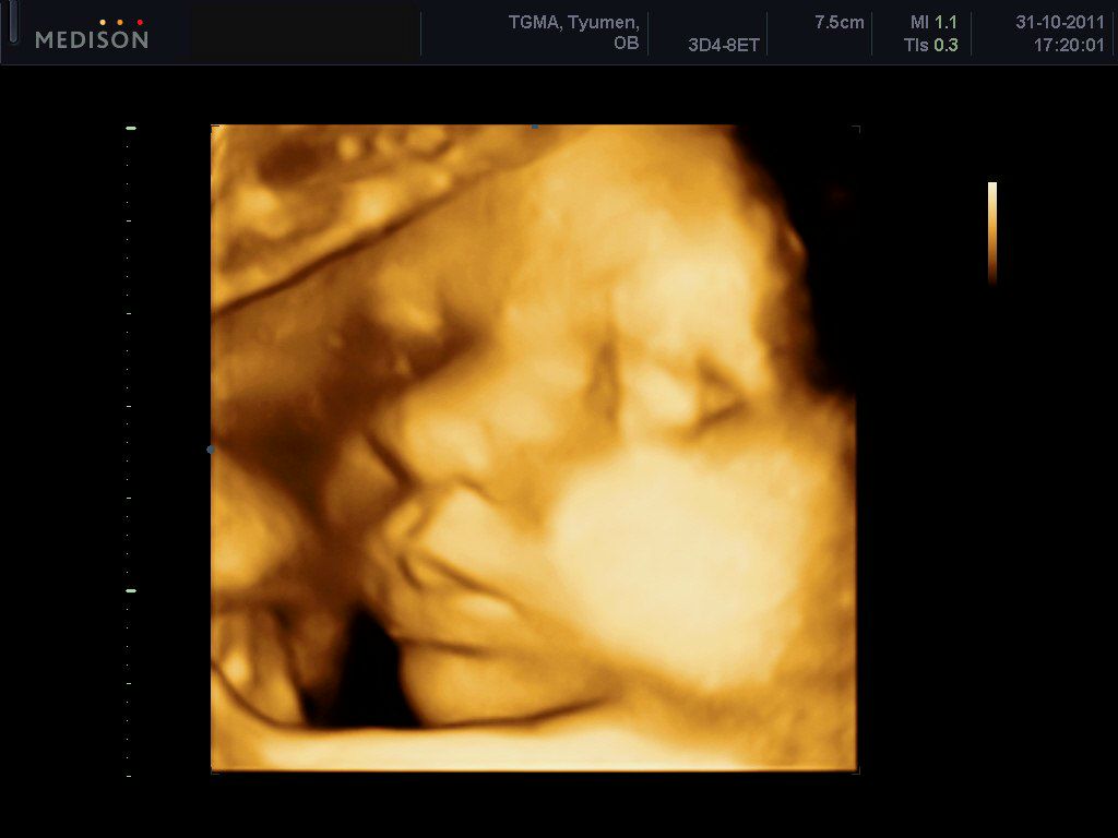 Нася Горина-Жедик | Тюмень