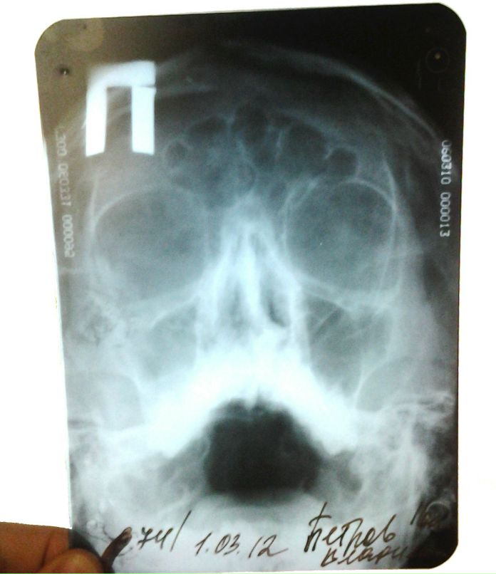 Вова Петров | Челябинск