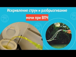 🤔 Искривление струи и разбрызгивание мочи при ВПЧ. Клинический случай №1083
