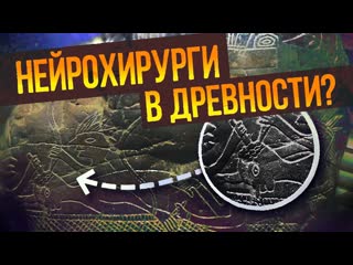 Андрей Жуков Камни Ики - Древняя медицина